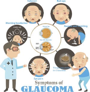 Glaucoma Symptoms