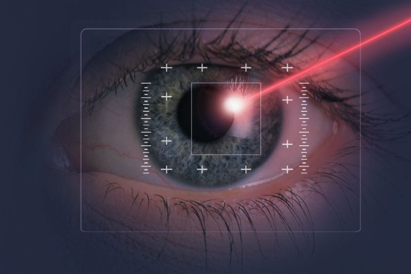 Laser Eye Surgery for Glaucoma