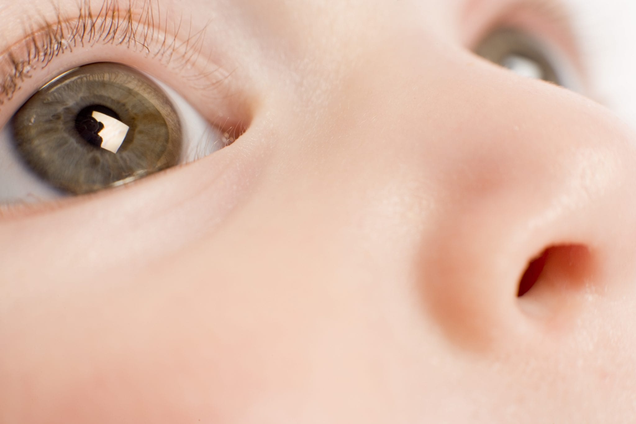eye, vision, infant. florida eye
