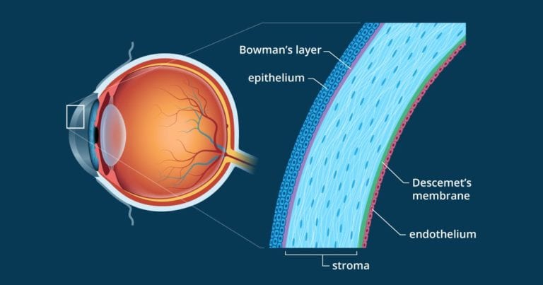 Corneal Services and Treatments | Florida Eye