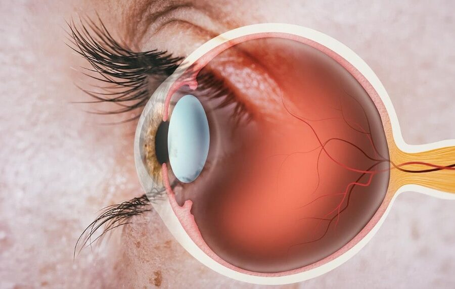 retina issues illustration